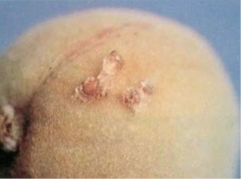 MEYVE ÜRETİCİLERİNE UYARI