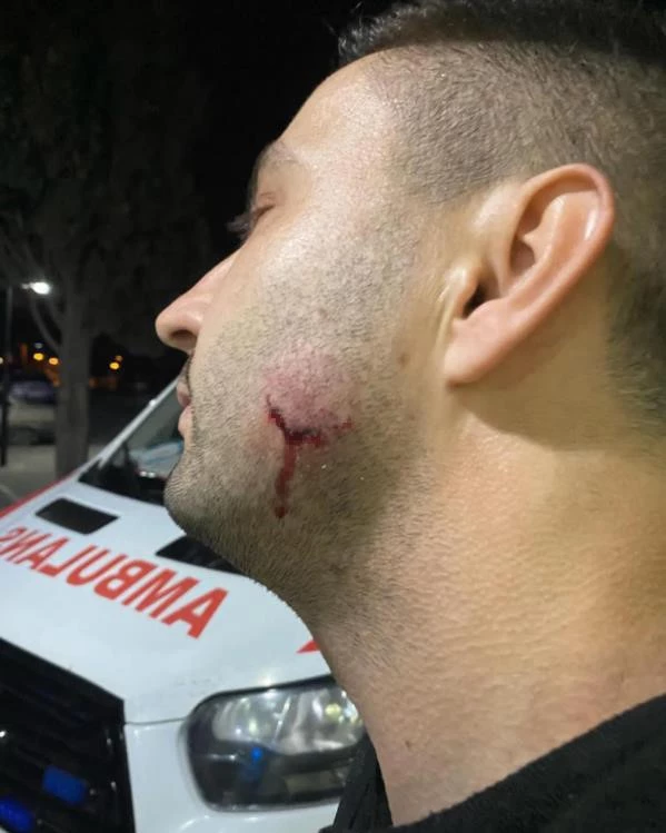 SALDIRGAN UZMAN ÇAVUŞ AÇIĞA ALINDI