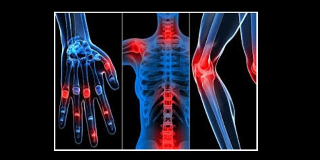 BU HASTALIĞI BİLİYOR MUSUNUZ?