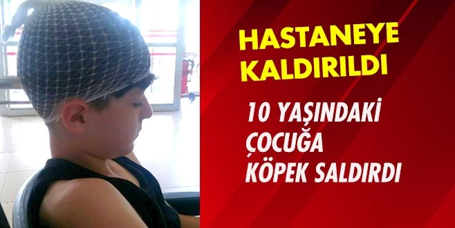 SOKAK KÖPEĞİNİN SALDIRDIĞI ÇOCUK YARALANDI