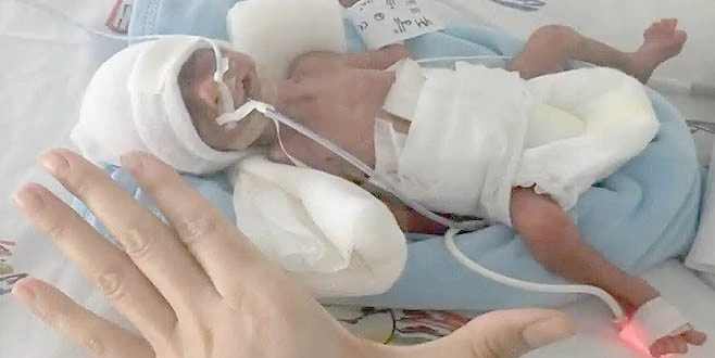 KÜÇÜK MELEKLERİN YAŞAMA TUTUNMASI