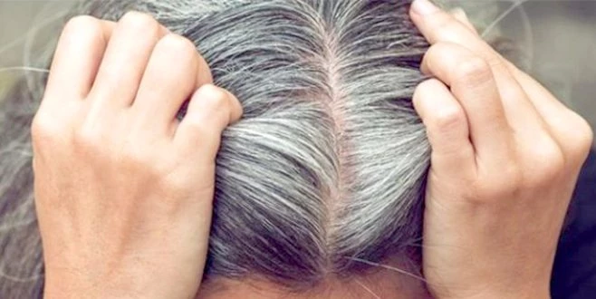 STRES SAÇLARI BEYAZLATIYOR