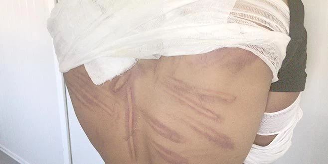 YUNANİSTAN`DAN İNSANLIK DIŞI HAREKET