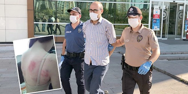  KIZINI İNGİLİZ ANAHTARI İLE DÖVDÜĞÜ ÖNE SÜRÜLEN BABA TUTUKLANDI